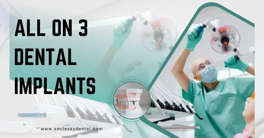 All-On-3-Dental-Implants