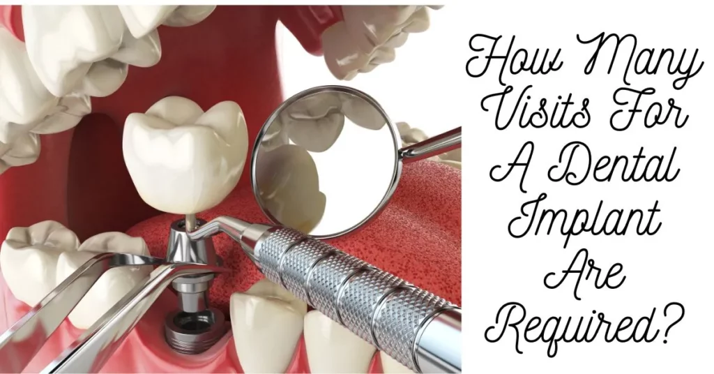 how many visits for a dental implant