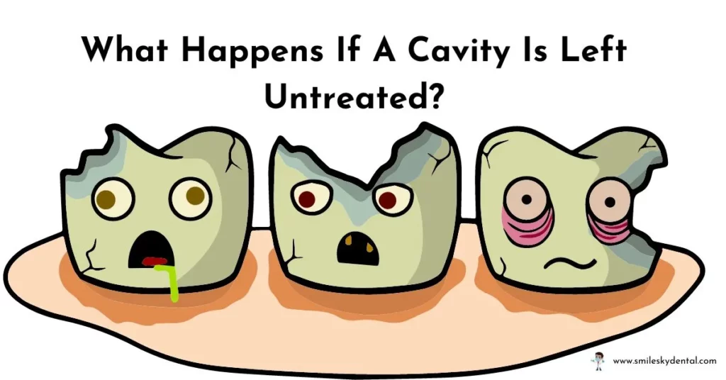 What-Happens-If-A-Cavity-Is-Left-Untreated