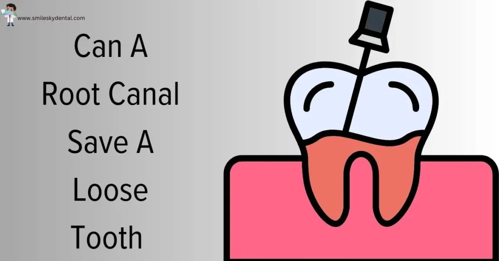 Can-A-Root-Canal-Save-A-Loose-Tooth