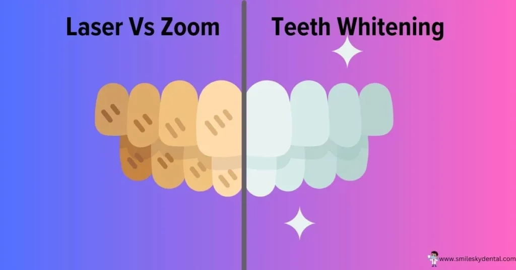 Laser-Vs-Zoom-Teeth-Whitening