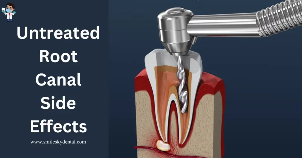 Untreated Root Canal Side Effects