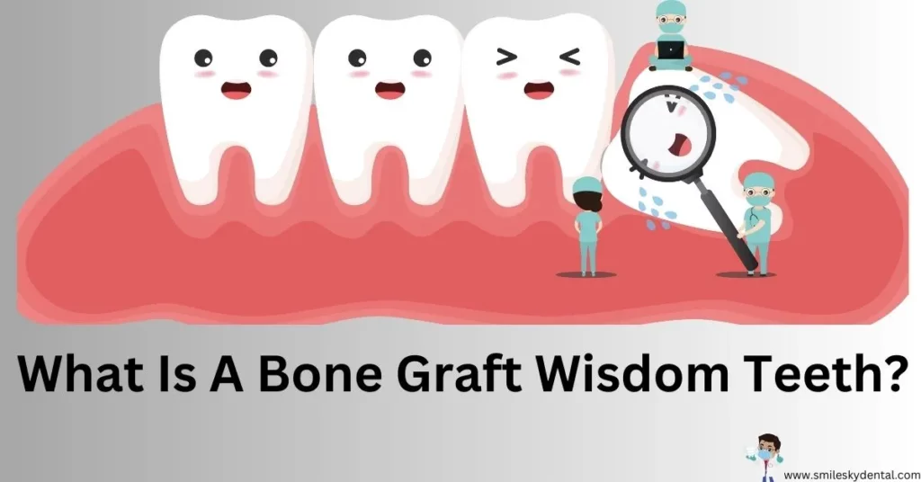 What Is A Bone Graft Wisdom Teeth