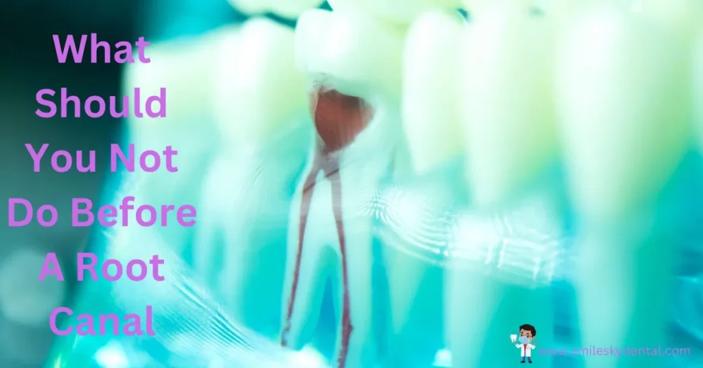 What Should You Not Do Before A Root Canal