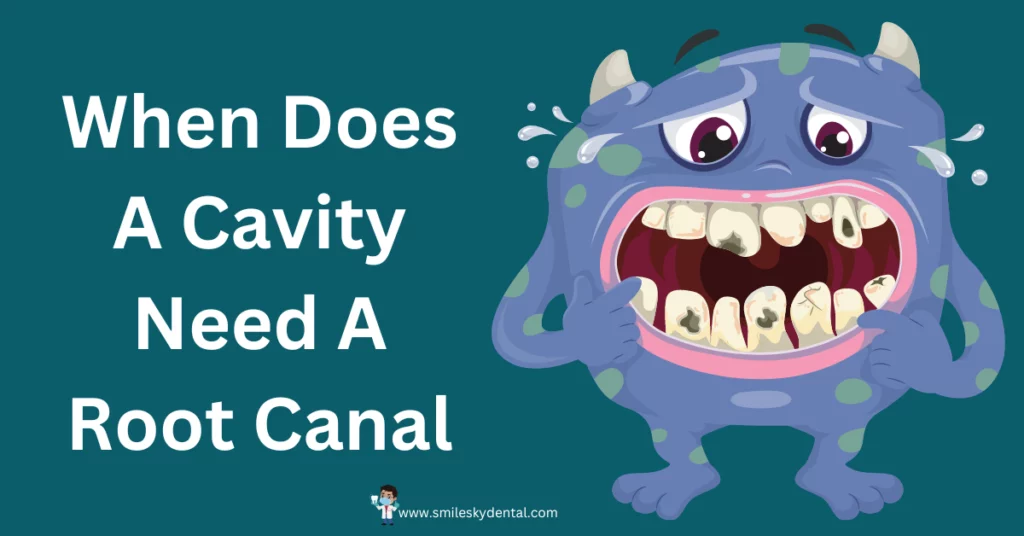 When-Does-A-Cavity-Need-A-Root-Canal