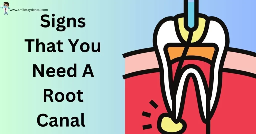 signs that you need a root canal