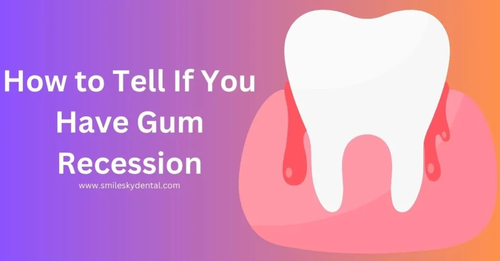 How-to-Tell-If-You-Have-Gum-Recession