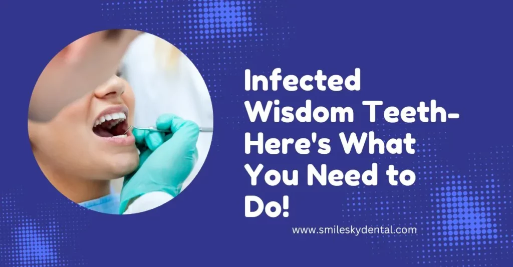 Infected-Wisdom-Teeth-Here_s-What-You-Need-to-Do_