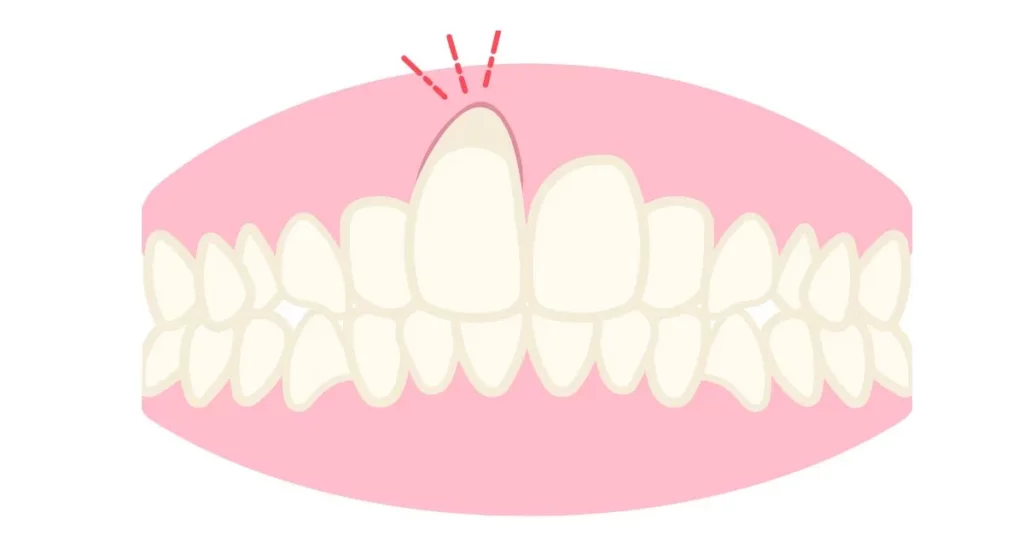 Periodontist-Receding-Gums-Recognizing-the-Signs