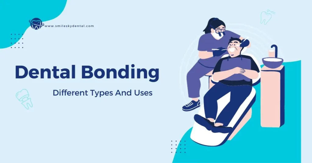 Dental-Bonding-Exploring-Types-And-Uses