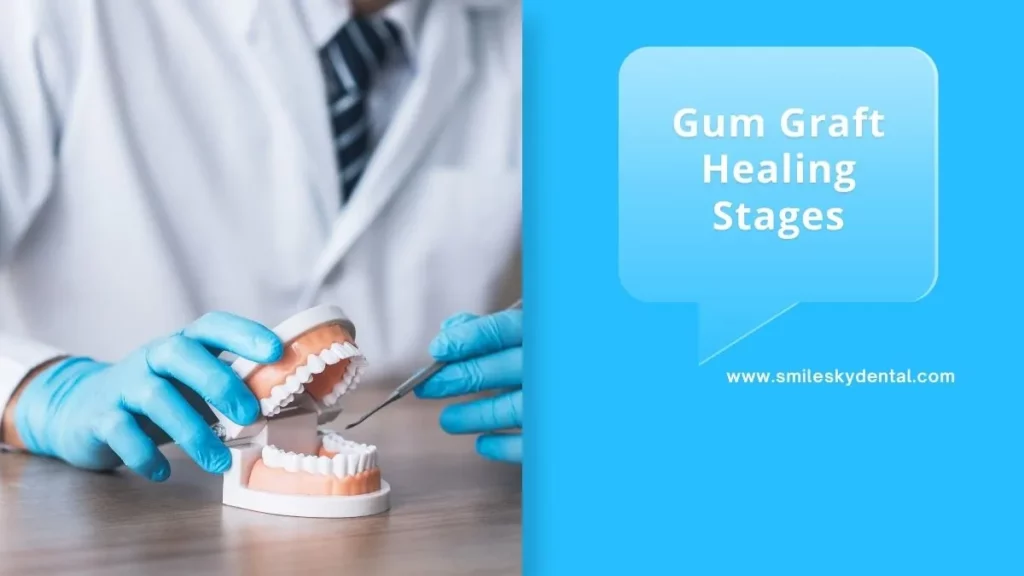 Gum-Graft-Healing-Stages-Exploring-The-Unknown