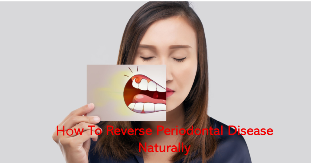 How-To-Reverse-Periodontal-Disease-Naturally